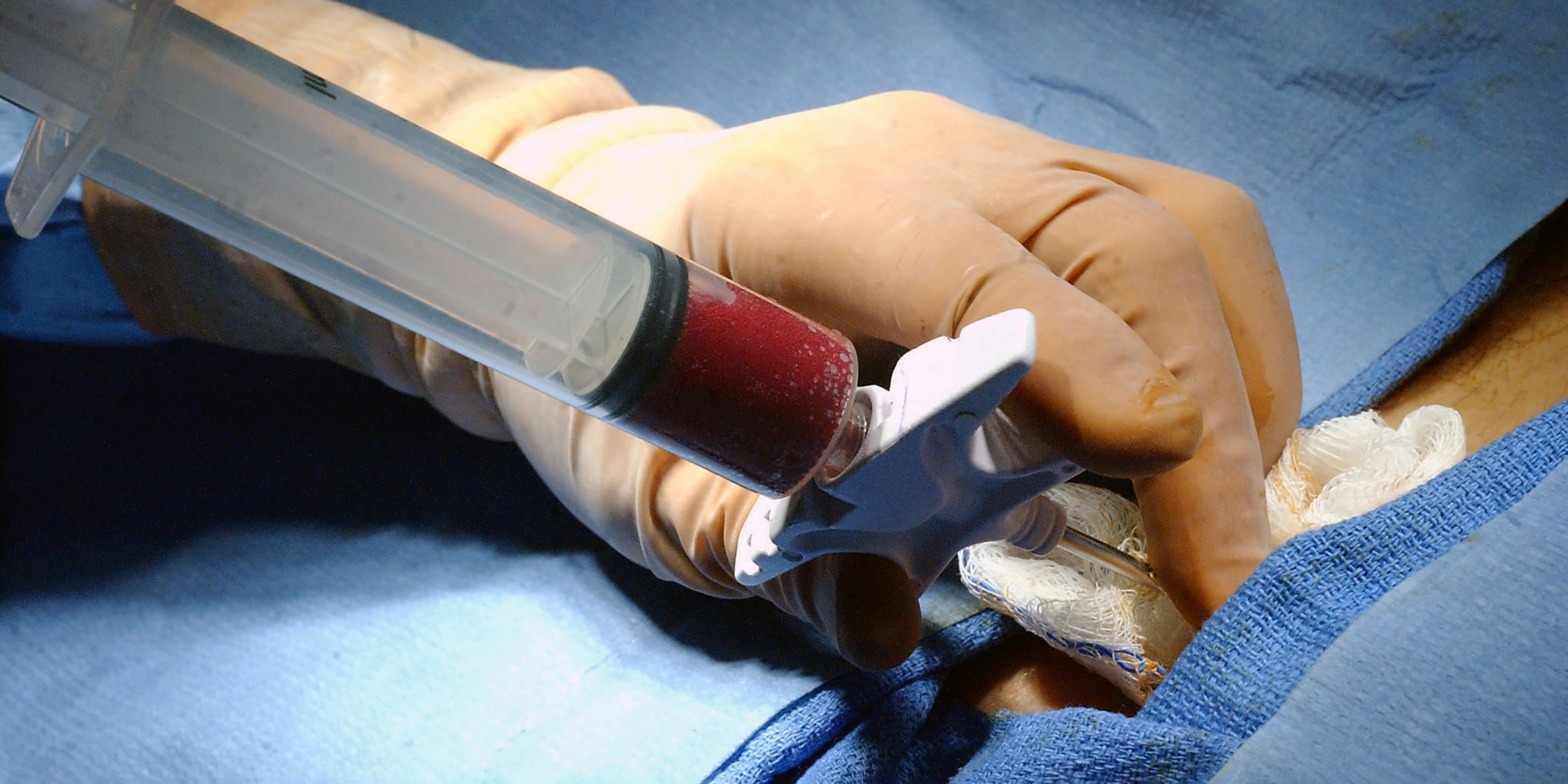 Image of bone marrow being drawn from a patient