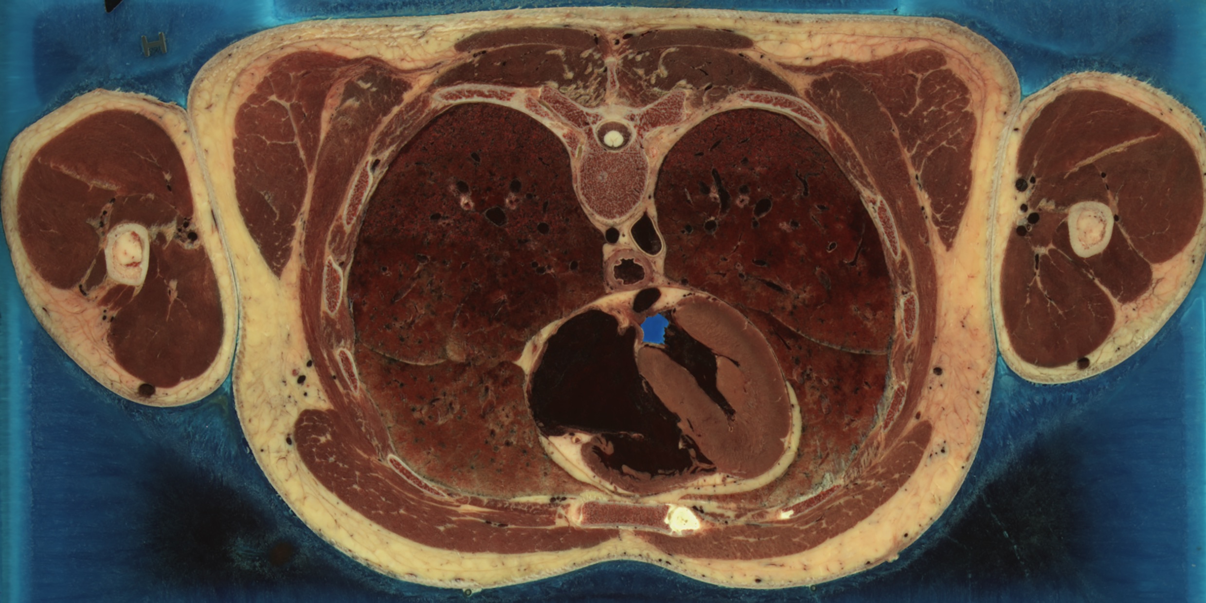 Anatomical cross-section image of the human body